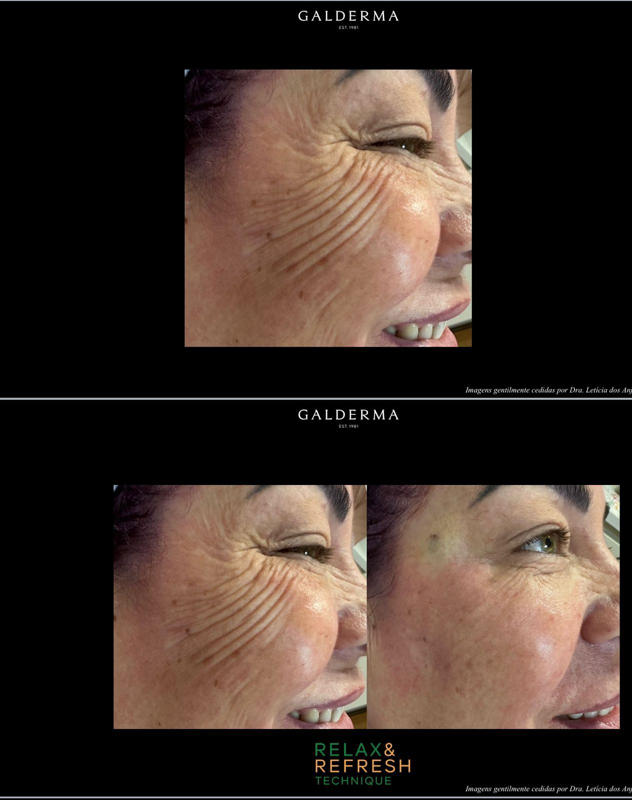 Antes e depois de cuidado facial na Atual Estética — caso 10
